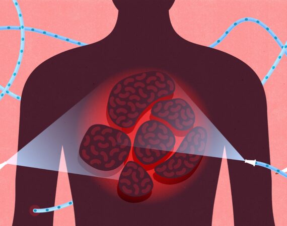 db9dee87208483.5db0bec592003