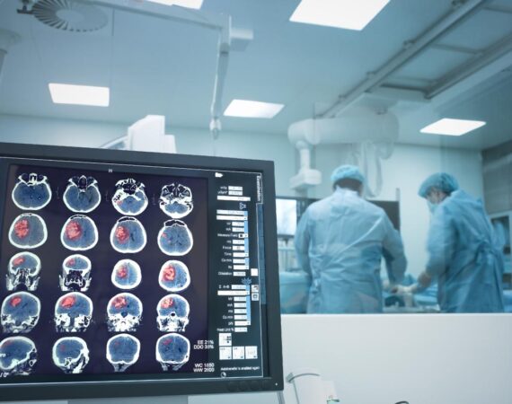neurosurgery