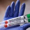 В Таджикистане не выявлено случаев хантавируса